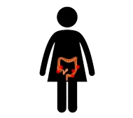 Diverticulitis