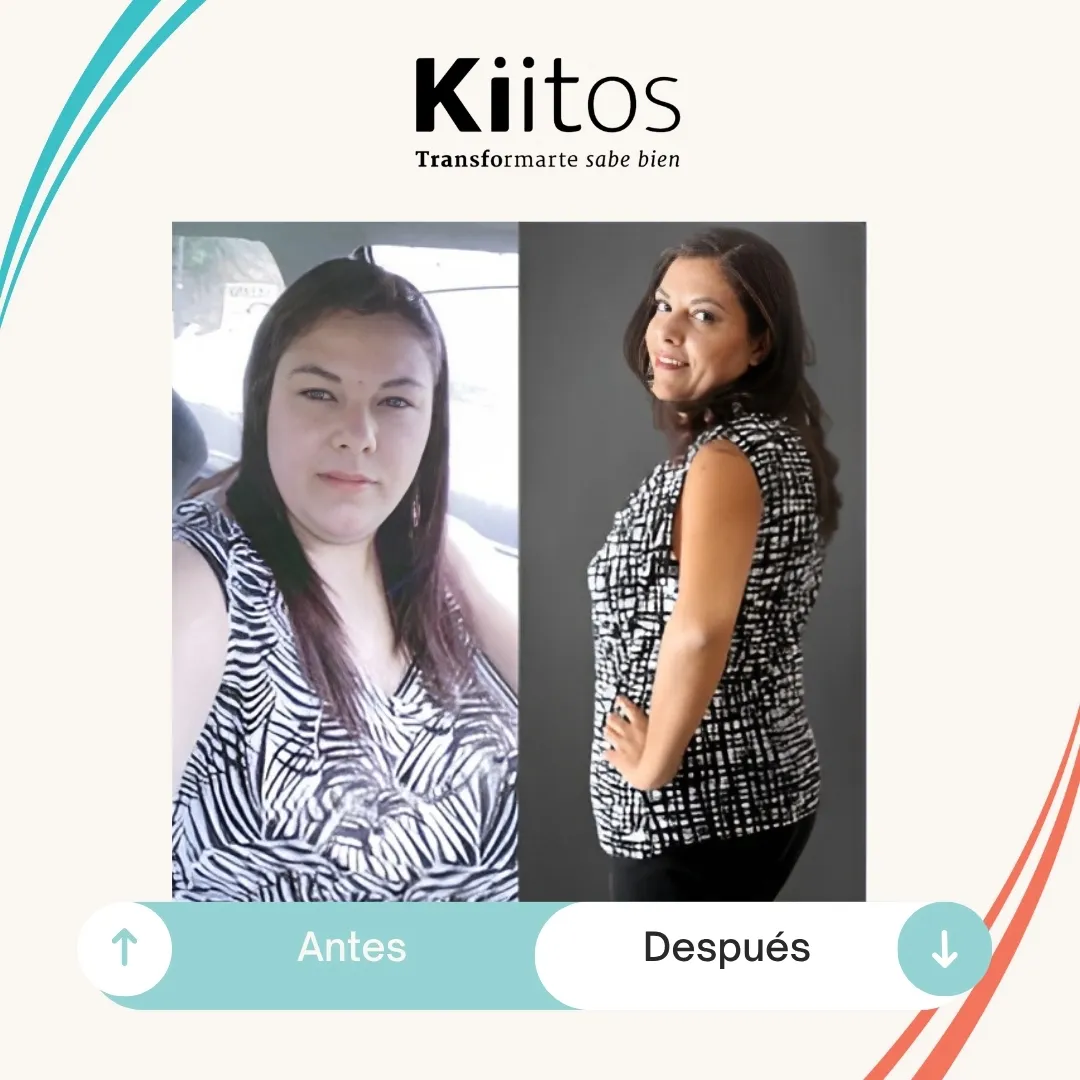 Transformación de paciente Kiitos 21