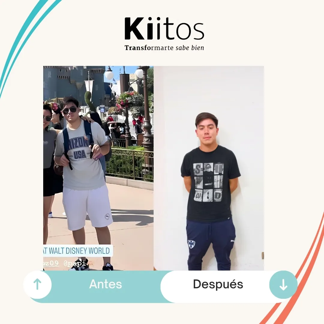 Transformación de paciente Kiitos 30