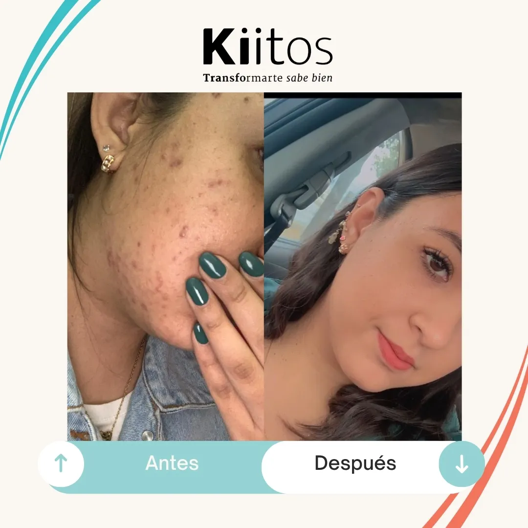 Transformación de paciente Kiitos
